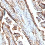 FFPE human placenta sections stained with 100 ul anti-Galectin-13 (clone PP13/1161) at 1:400. HIER epitope retrieval prior to staining was performed in 10mM Citrate, pH 6.0 or 10mM Tris 1mM EDTA, pH 9.0.